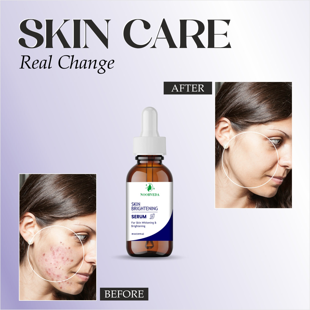 Noorveda Skin Brightening Serum, Non-Sticky Formula for Oily and Sensitive Skin, Advanced Vitamin C Treatment for Glowing Complexion, 30ml