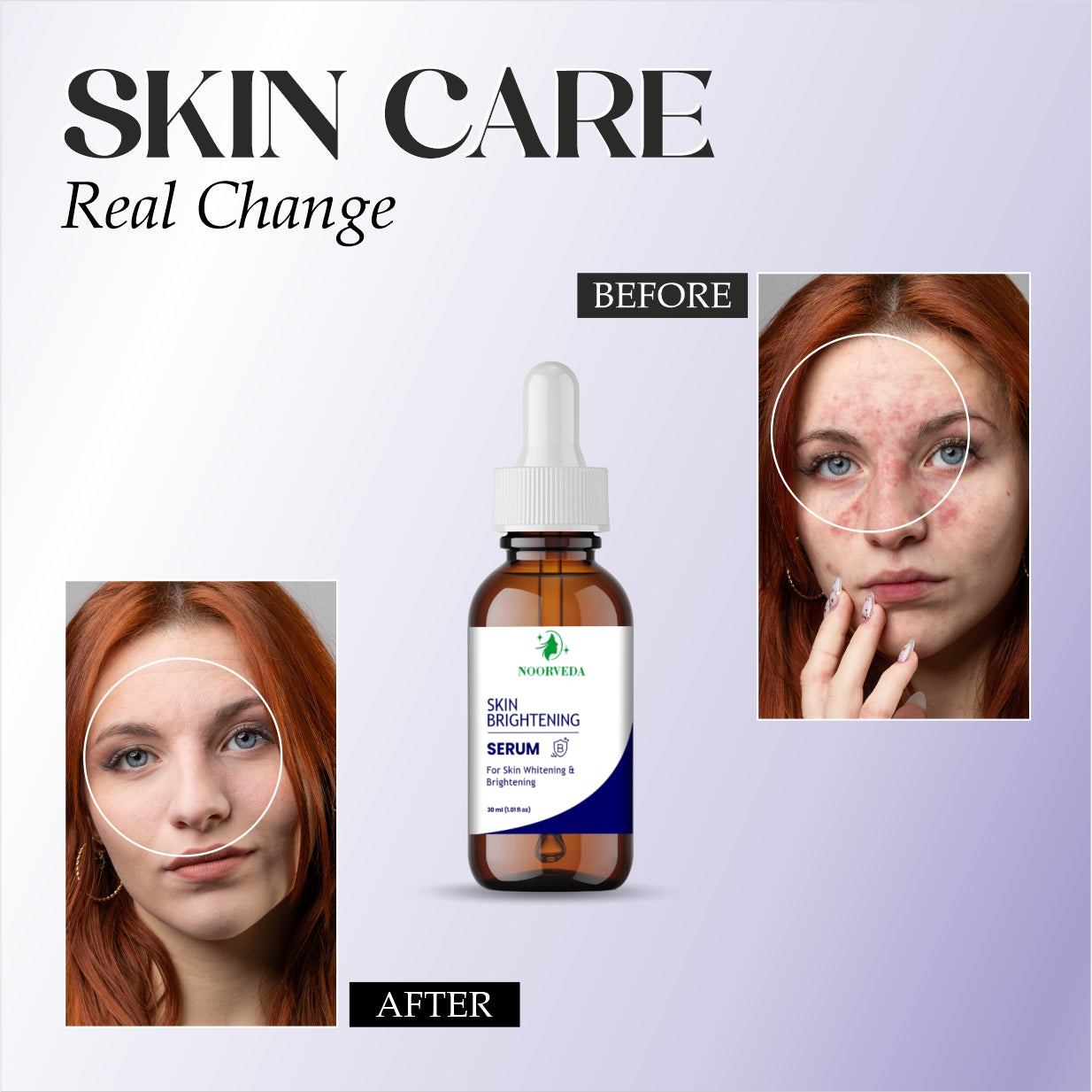 Noorveda Skin Brightening Serum, Non-Sticky Formula for Oily and Sensitive Skin, Advanced Vitamin C Treatment for Glowing Complexion, 30ml