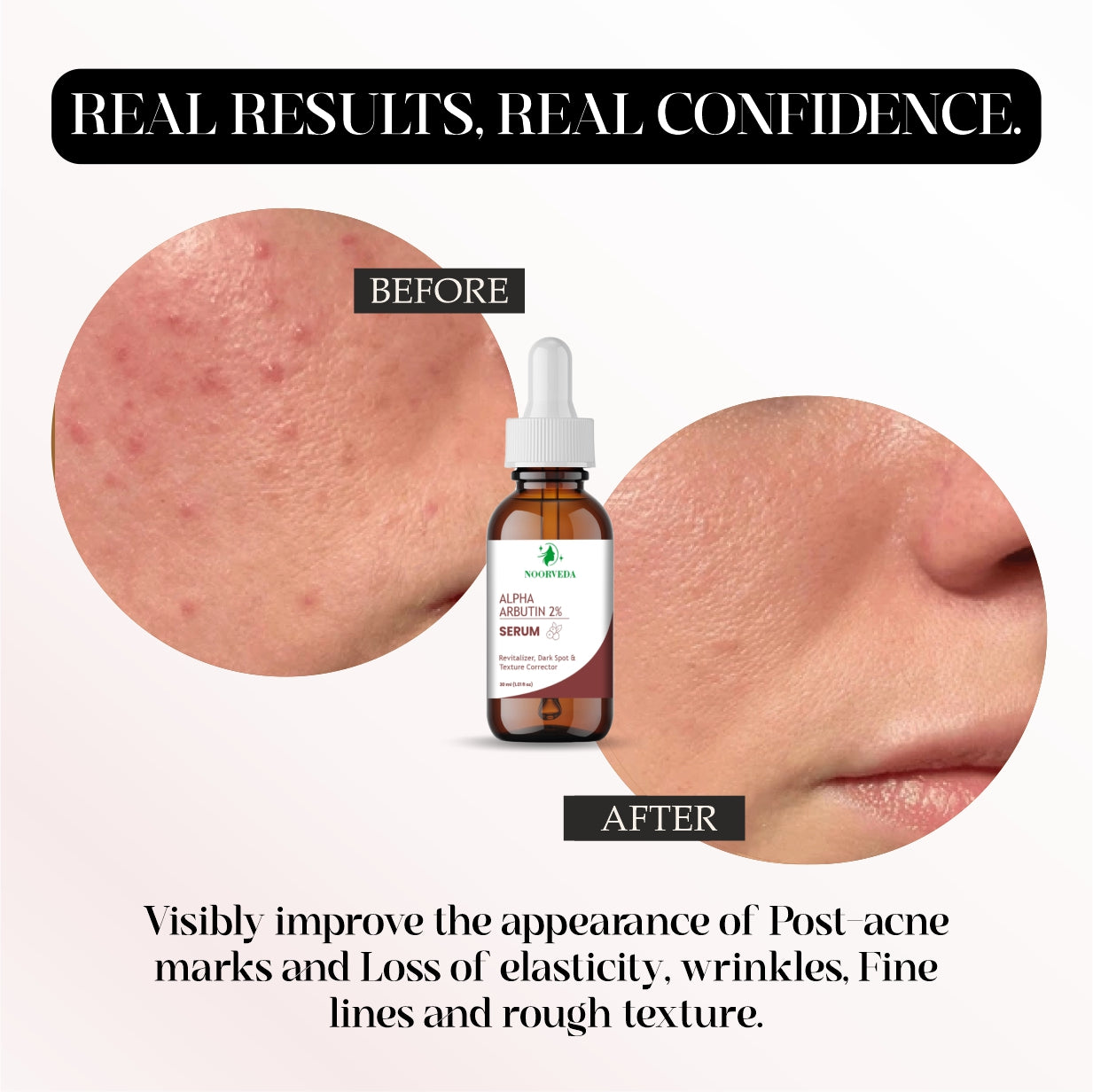 Alpha Arbutin 2% Serum, Dark Spot and Texture Corrector, Revitalizer, 30ml