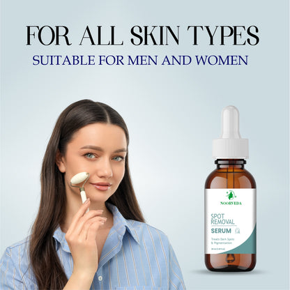 Noorveda Spot Removal Serum, Dark Spots and Pigmentation Treatment, 30ml Dropper Bottle